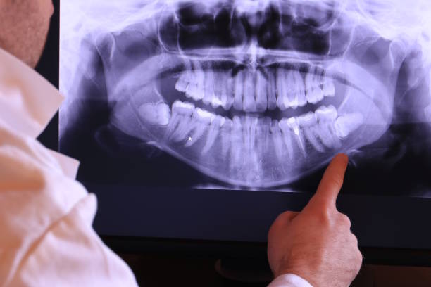 Best Emergency Treatment for Toothache in Kirksville, MO